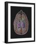 View of Limbic System as Seen from Directly Above the Head-null-Framed Art Print