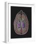 View of Limbic System as Seen from Directly Above the Head-null-Framed Art Print