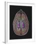 View of Limbic System as Seen from Directly Above the Head-null-Framed Art Print