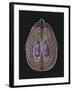 View of Limbic System as Seen from Directly Above the Head-null-Framed Art Print