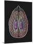 View of Limbic System as Seen from Directly Above the Head-null-Mounted Art Print