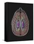 View of Limbic System as Seen from Directly Above the Head-null-Framed Stretched Canvas