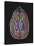 View of Limbic System as Seen from Directly Above the Head-null-Stretched Canvas