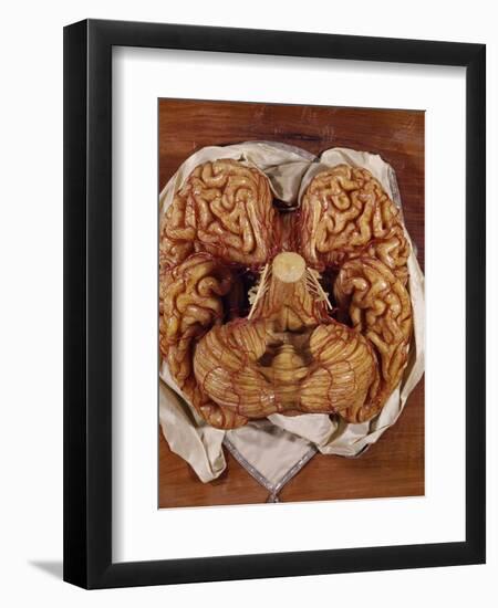 Wax Sculpture of a Brain-Clemente Susini-Framed Giclee Print