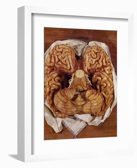 Wax Sculpture of a Brain-Clemente Susini-Framed Giclee Print