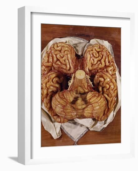 Wax Sculpture of a Brain-Clemente Susini-Framed Giclee Print