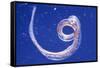 Whipworm Parasite-null-Framed Stretched Canvas