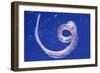 Whipworm Parasite-null-Framed Photographic Print