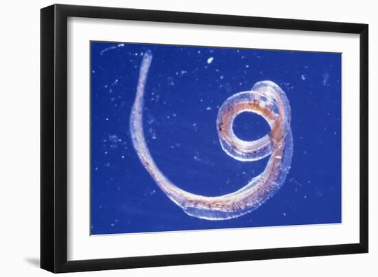 Whipworm Parasite-null-Framed Photographic Print