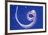 Whipworm Parasite-null-Framed Photographic Print