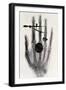 Wilhelm Roentgen's X-Ray Photograph of His Wife's Hand, 1896-Wilhelm Conrad Rontgen-Framed Giclee Print