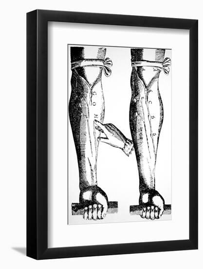 William Harvey Woodcut Showing Venous Valves-Science Photo Library-Framed Photographic Print