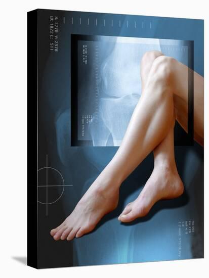 Woman's Legs, with Knee X-ray-Miriam Maslo-Stretched Canvas