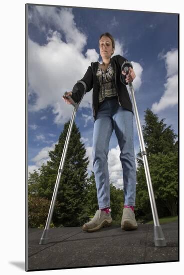 Woman Standing on Crutches-Anthony West-Mounted Photographic Print