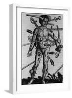 Wound Man Illustrates Effects of Different Weapons. by Hans Wechtlin, Ca. 1500-null-Framed Art Print