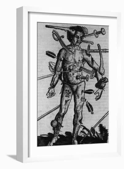 Wound Man Illustrates Effects of Different Weapons. by Hans Wechtlin, Ca. 1500-null-Framed Art Print