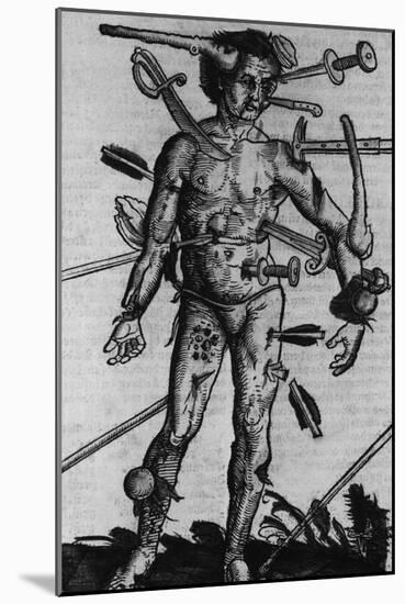 Wound Man Illustrates Effects of Different Weapons. by Hans Wechtlin, Ca. 1500-null-Mounted Art Print