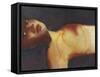 Wounded-Graham Dean-Framed Stretched Canvas