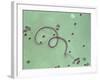 Wuchereria Bancrofti Parasite-Sinclair Stammers-Framed Photographic Print