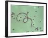 Wuchereria Bancrofti Parasite-Sinclair Stammers-Framed Photographic Print