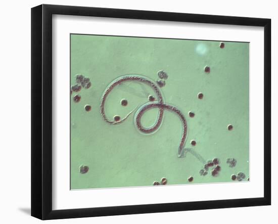 Wuchereria Bancrofti Parasite-Sinclair Stammers-Framed Photographic Print