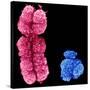 X And Y Chromosomes-Science Photo Library-Stretched Canvas