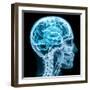 X-Ray close up with Brain and Skull Concept-Digital Storm-Framed Art Print