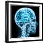 X-Ray close up with Brain and Skull Concept-Digital Storm-Framed Art Print