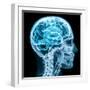 X-Ray close up with Brain and Skull Concept-Digital Storm-Framed Art Print