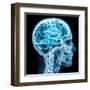 X-Ray close up with Brain and Skull Concept-Digital Storm-Framed Art Print