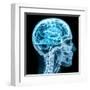 X-Ray close up with Brain and Skull Concept-Digital Storm-Framed Art Print