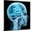 X-Ray close up with Brain and Skull Concept-Digital Storm-Mounted Art Print