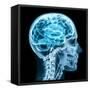 X-Ray close up with Brain and Skull Concept-Digital Storm-Framed Stretched Canvas