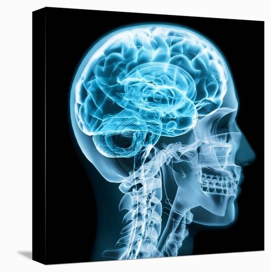 X-Ray close up with Brain and Skull Concept-Digital Storm-Stretched Canvas