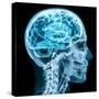 X-Ray close up with Brain and Skull Concept-Digital Storm-Stretched Canvas