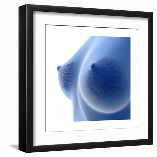 X-Ray Image of Female Breast Anatomy-null-Framed Art Print