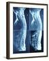 X-Ray Image of Person's Spine on Computer Screen-null-Framed Photographic Print