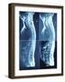 X-Ray Image of Person's Spine on Computer Screen-null-Framed Photographic Print