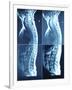 X-Ray Image of Person's Spine on Computer Screen-null-Framed Photographic Print