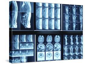 X-Ray Images on Computer Screen-null-Stretched Canvas