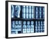 X-Ray Images on Computer Screen-null-Framed Photographic Print