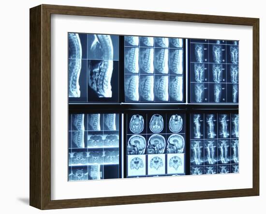 X-Ray Images on Computer Screen-null-Framed Photographic Print