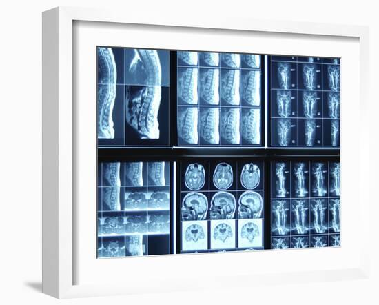 X-Ray Images on Computer Screen-null-Framed Photographic Print