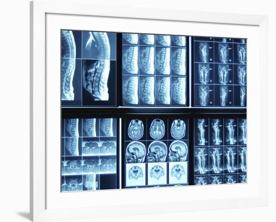 X-Ray Images on Computer Screen-null-Framed Photographic Print