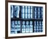 X-Ray Images on Computer Screen-null-Framed Photographic Print