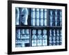 X-Ray Images on Computer Screen-null-Framed Photographic Print