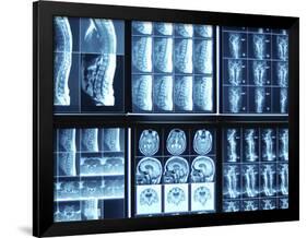 X-Ray Images on Computer Screen-null-Framed Photographic Print