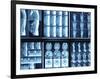 X-Ray Images on Computer Screen-null-Framed Photographic Print