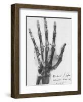 X-ray of a hand with buckshot-Science Source-Framed Giclee Print