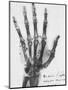 X-ray of a hand with buckshot-Science Source-Mounted Giclee Print
